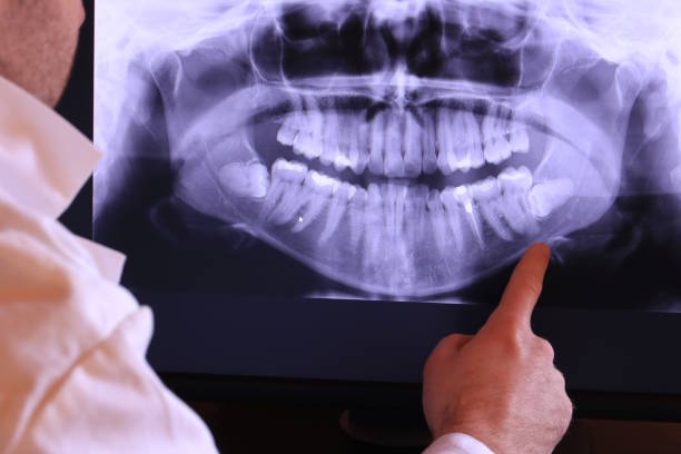 Best Emergency Root Canal Therapy in St John, MO