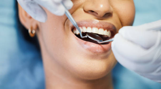 Best Broken or Chipped Tooth Repair in St John, MO